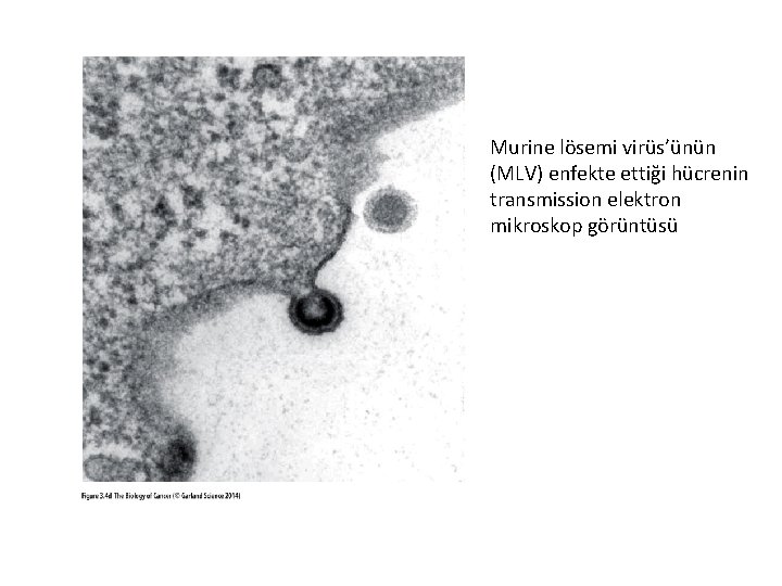 Murine lösemi virüs’ünün (MLV) enfekte ettiği hücrenin transmission elektron mikroskop görüntüsü 