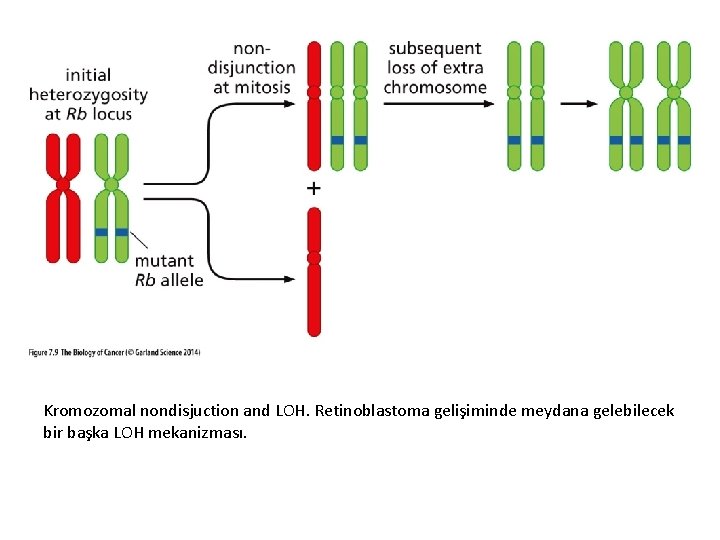 Kromozomal nondisjuction and LOH. Retinoblastoma gelişiminde meydana gelebilecek bir başka LOH mekanizması. 
