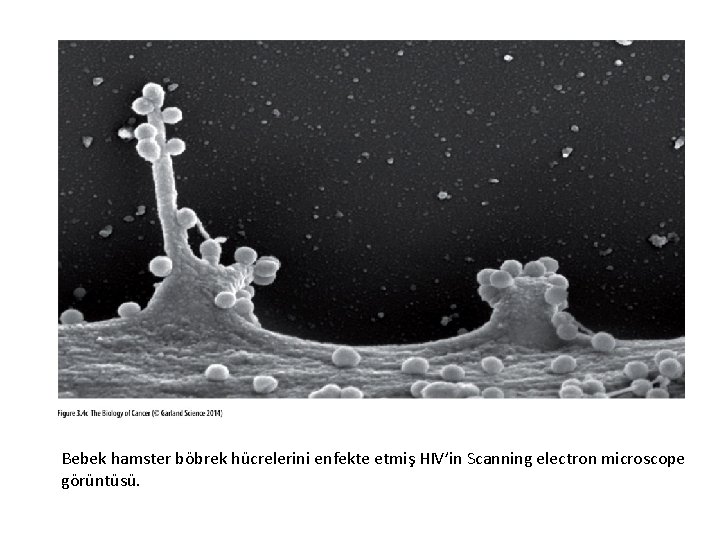 Bebek hamster böbrek hücrelerini enfekte etmiş HIV’in Scanning electron microscope görüntüsü. 