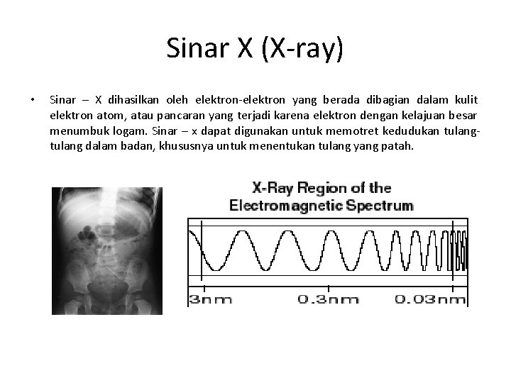 Sinar X (X-ray) • Sinar – X dihasilkan oleh elektron-elektron yang berada dibagian dalam