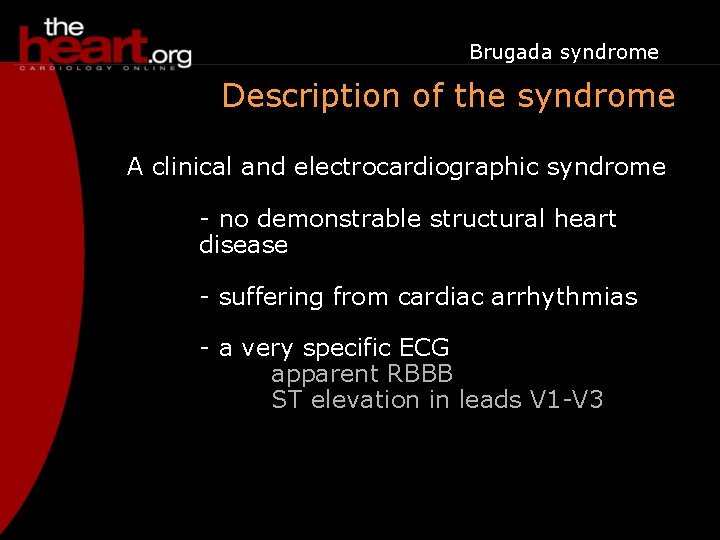 Brugada syndrome Description of the syndrome A clinical and electrocardiographic syndrome - no demonstrable