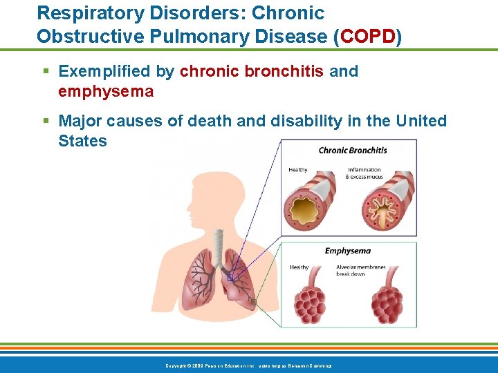 Respiratory Disorders: Chronic Obstructive Pulmonary Disease (COPD) § Exemplified by chronic bronchitis and emphysema