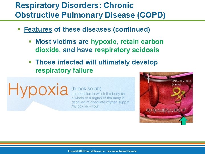 Respiratory Disorders: Chronic Obstructive Pulmonary Disease (COPD) § Features of these diseases (continued) §