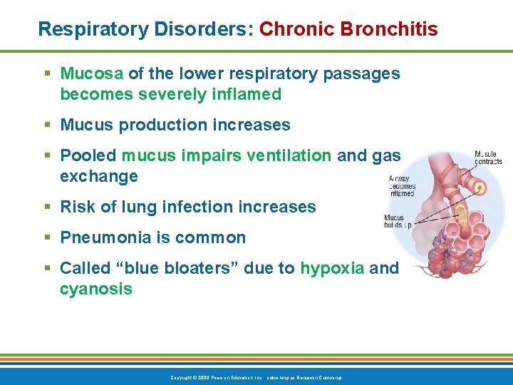 Respiratory Disorders: Chronic Bronchitis § Mucosa of the lower respiratory passages becomes severely inflamed