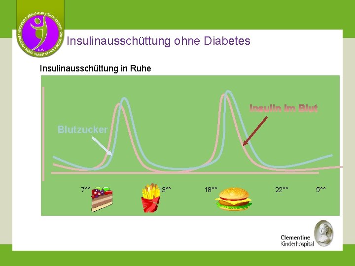 Insulinausschüttung ohne Diabetes Insulinausschüttung in Ruhe Blutzucker 7°° 13°° 18°° 22°° 5°° 