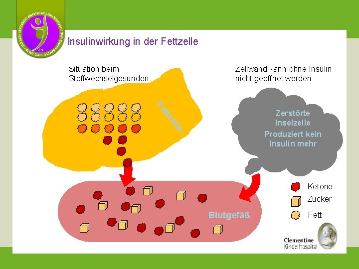 Insulinwirkung in der Fettzelle Zellwand kann ohne Insulin nicht geöffnet werden Situation beim Stoffwechselgesunden