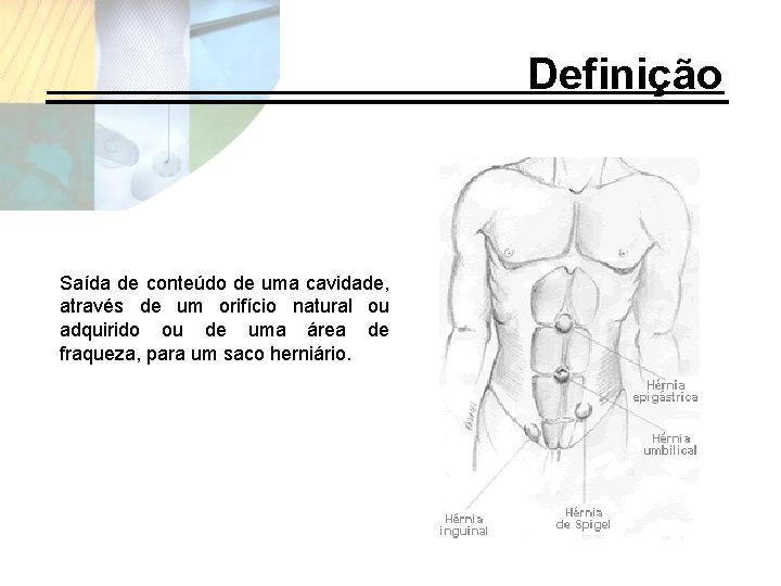 Definição Saída de conteúdo de uma cavidade, através de um orifício natural ou adquirido