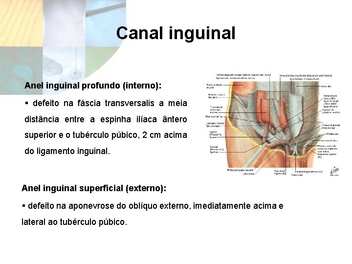 Canal inguinal Anel inguinal profundo (interno): § defeito na fáscia transversalis a meia distância