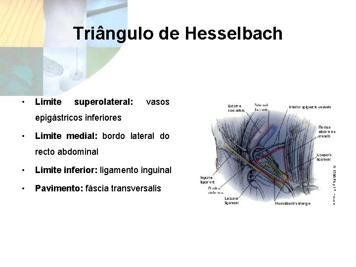 Triângulo de Hesselbach • Limite superolateral: vasos epigástricos inferiores • Limite medial: bordo lateral
