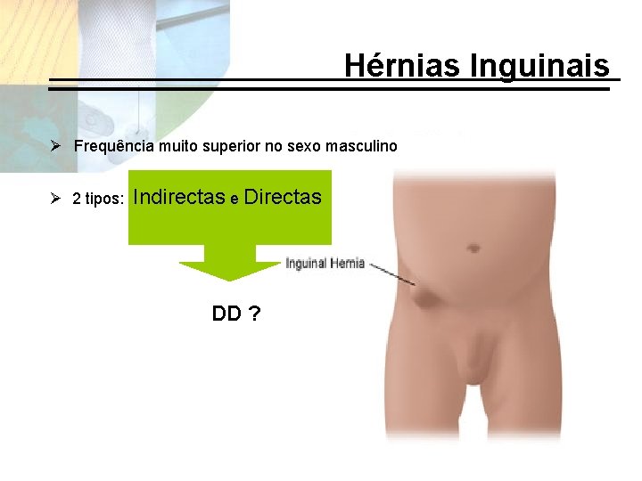 Hérnias Inguinais Ø Frequência muito superior no sexo masculino Ø 2 tipos: Indirectas e