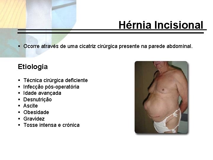 Hérnia Incisional § Ocorre através de uma cicatriz cirúrgica presente na parede abdominal. Etiologia