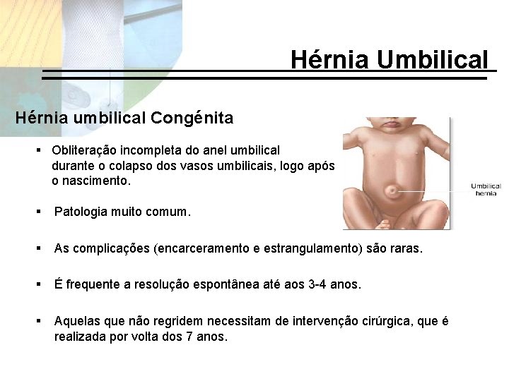 Hérnia Umbilical Hérnia umbilical Congénita § Obliteração incompleta do anel umbilical … durante o
