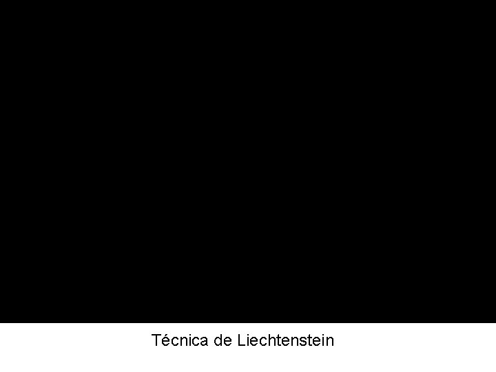 Técnica de Liechtenstein 