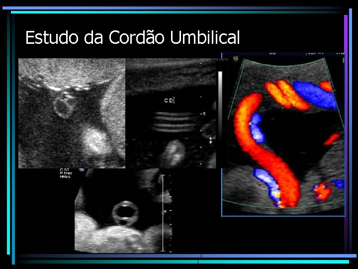 Estudo da Cordão Umbilical 
