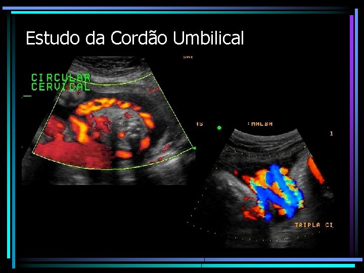 Estudo da Cordão Umbilical 