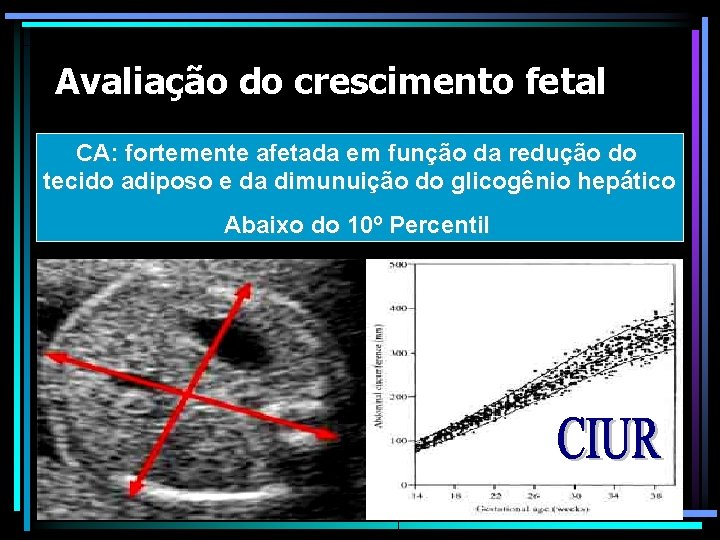 Avaliação do crescimento fetal CA: fortemente afetada em função da redução do tecido adiposo