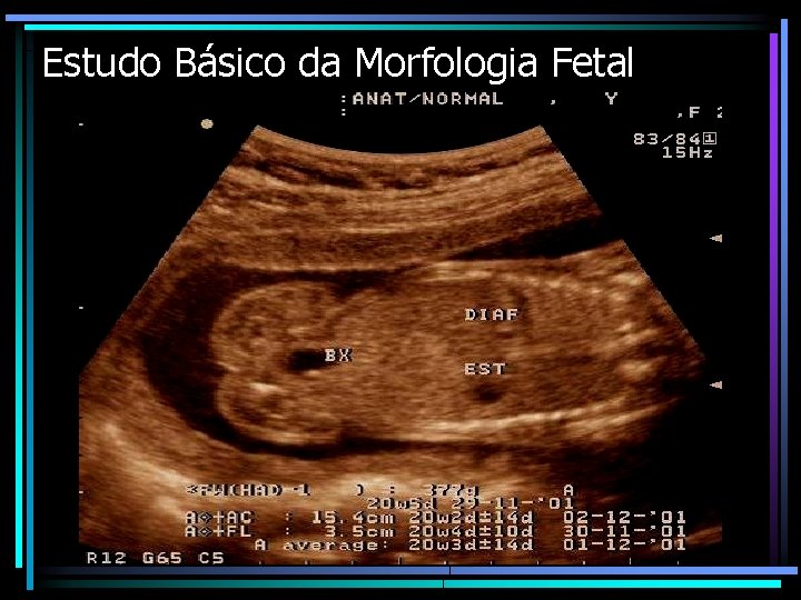 Estudo Básico da Morfologia Fetal 