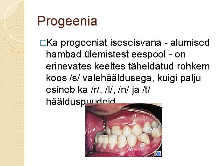 Progeenia �Ka progeeniat iseseisvana - alumised hambad ülemistest eespool - on erinevates keeltes täheldatud