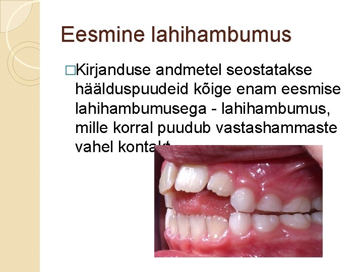 Eesmine lahihambumus �Kirjanduse andmetel seostatakse häälduspuudeid kõige enam eesmise lahihambumusega - lahihambumus, mille korral