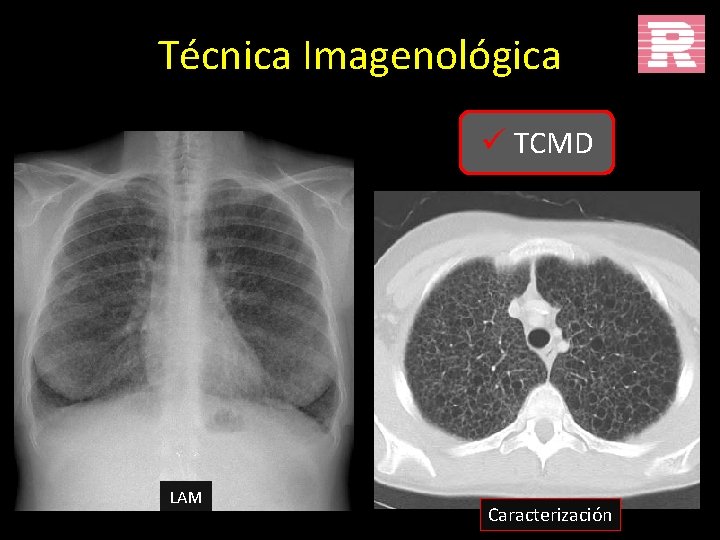 Técnica Imagenológica ü TCMD LAM Caracterización 