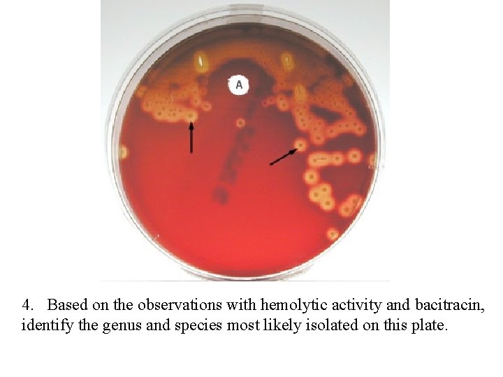 4. Based on the observations with hemolytic activity and bacitracin, identify the genus and