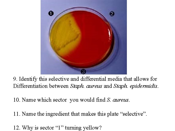 9. Identify this selective and differential media that allows for Differentiation between Staph. aureus