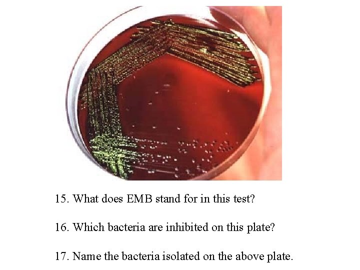 15. What does EMB stand for in this test? 16. Which bacteria are inhibited