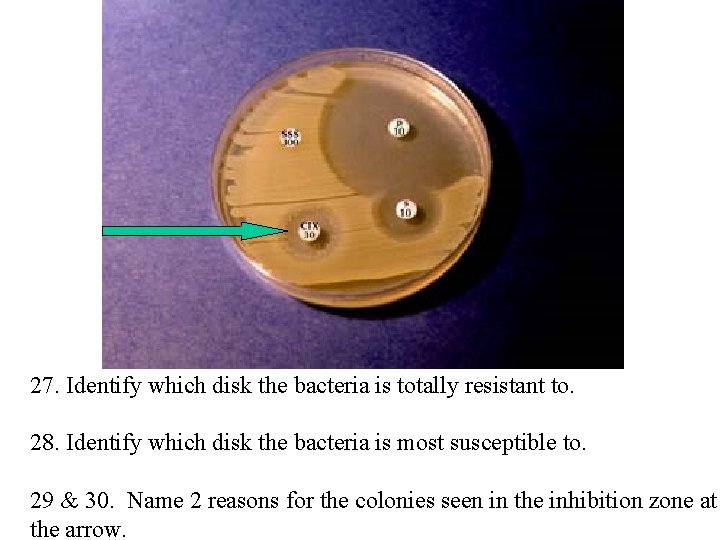 27. Identify which disk the bacteria is totally resistant to. 28. Identify which disk