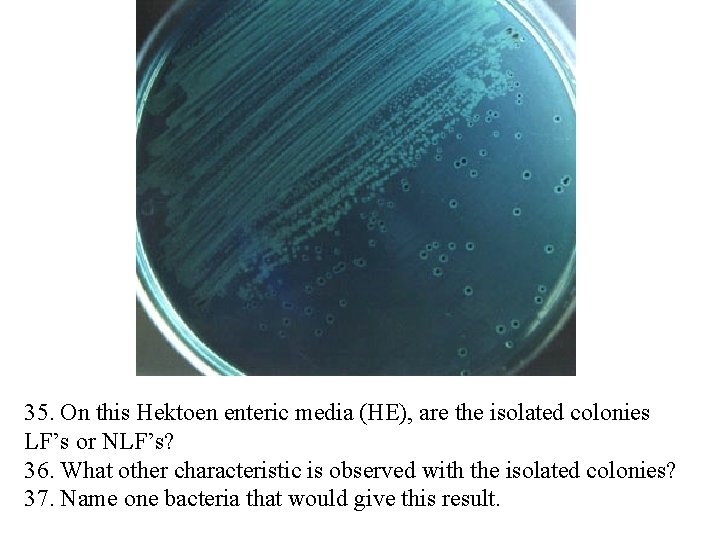 35. On this Hektoen enteric media (HE), are the isolated colonies LF’s or NLF’s?