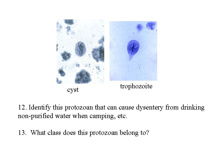 cyst trophozoite 12. Identify this protozoan that can cause dysentery from drinking non-purified water