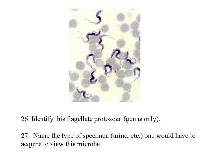 26. Identify this flagellate protozoan (genus only). 27. Name the type of specimen (urine,