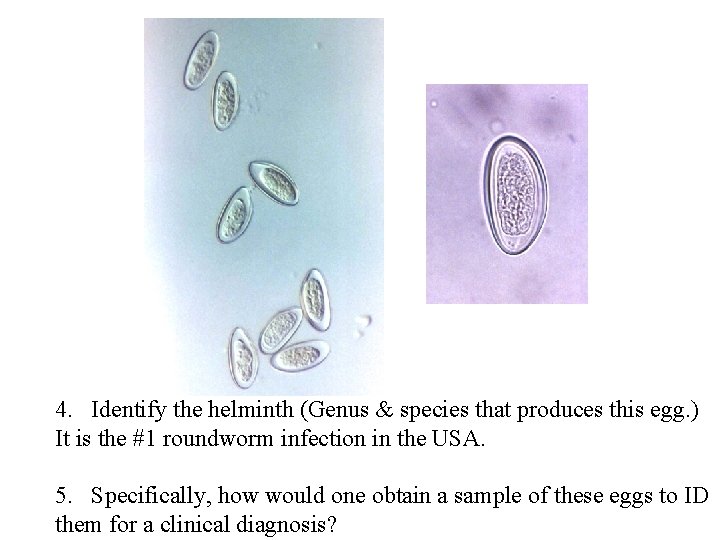 4. Identify the helminth (Genus & species that produces this egg. ) It is