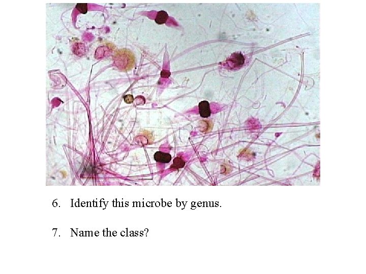 6. Identify this microbe by genus. 7. Name the class? 