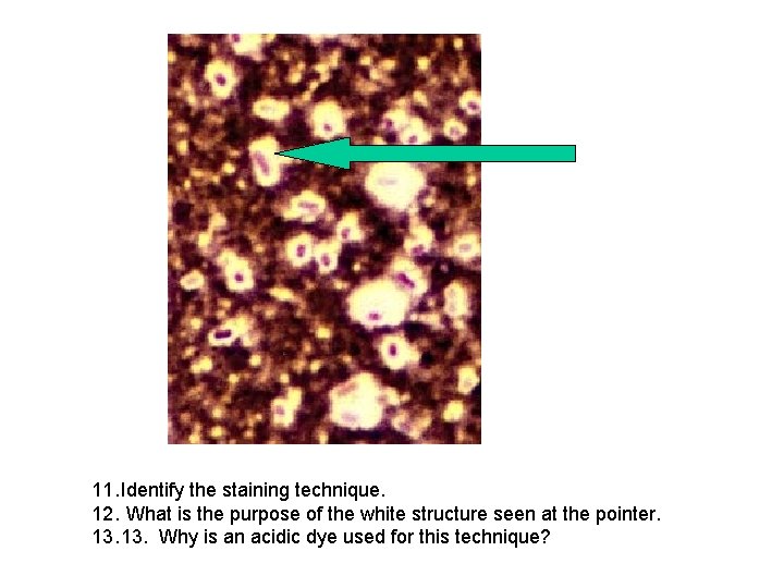 11. Identify the staining technique. 12. What is the purpose of the white structure