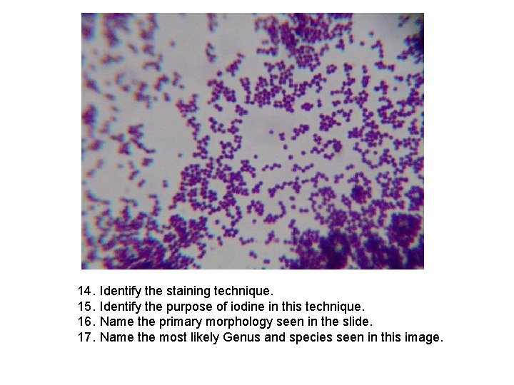 14. 15. 16. 17. Identify the staining technique. Identify the purpose of iodine in