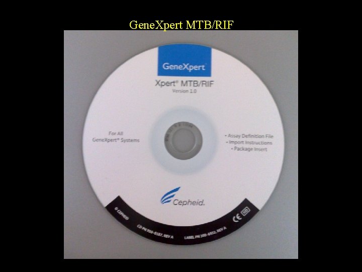 Gene. Xpert MTB/RIF 