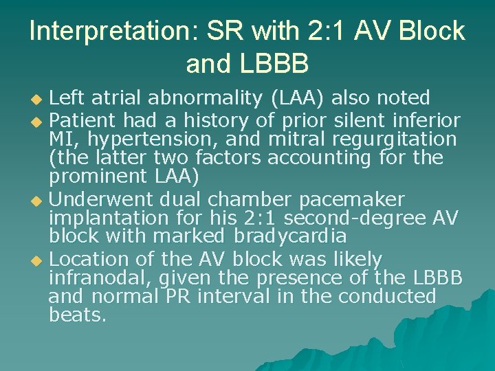 Interpretation: SR with 2: 1 AV Block and LBBB Left atrial abnormality (LAA) also
