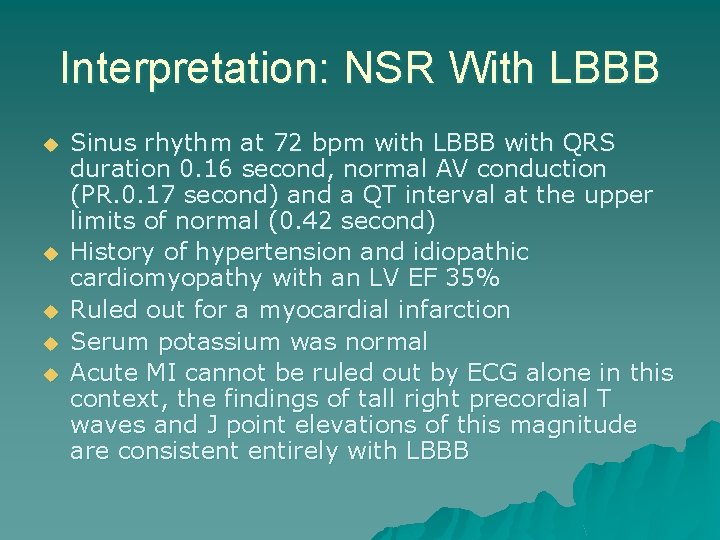 Interpretation: NSR With LBBB u u u Sinus rhythm at 72 bpm with LBBB