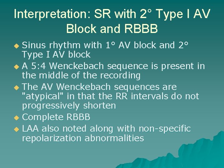 Interpretation: SR with 2° Type I AV Block and RBBB Sinus rhythm with 1°