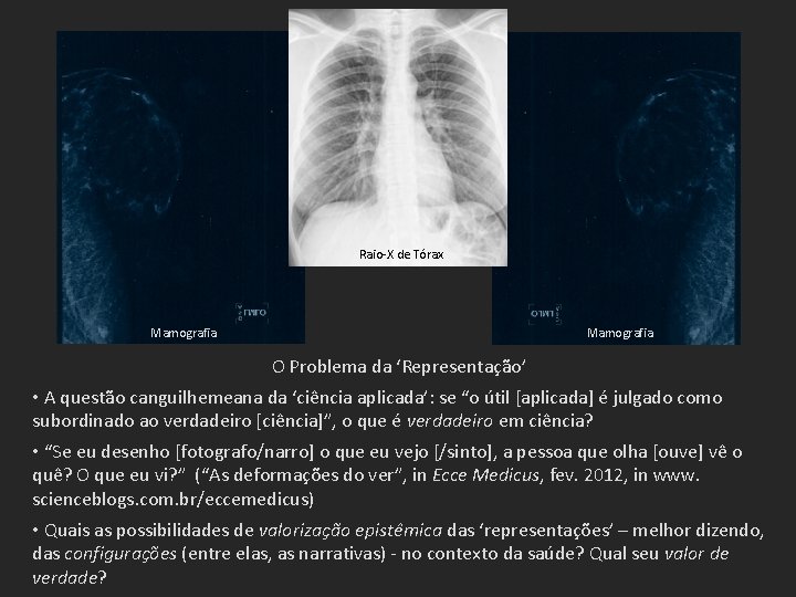 Raio-X de Tórax Mamografia O Problema da ‘Representação’ • A questão canguilhemeana da ‘ciência