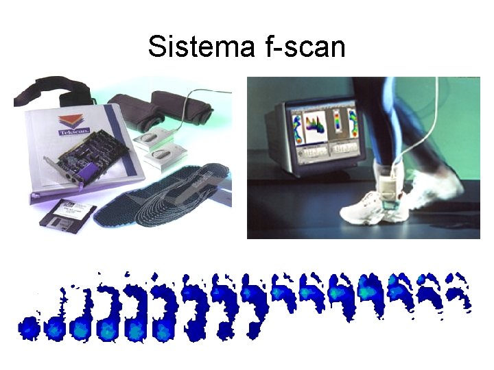Sistema f-scan 