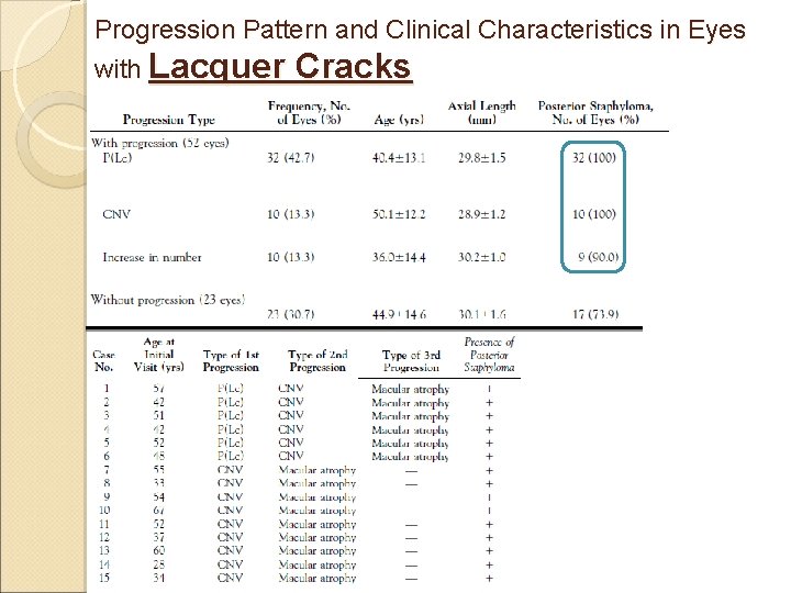 Progression Pattern and Clinical Characteristics in Eyes with Lacquer Cracks 
