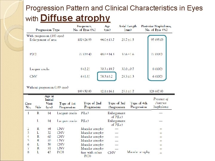 Progression Pattern and Clinical Characteristics in Eyes with Diffuse atrophy 