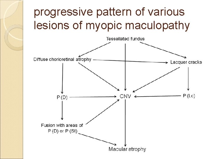 progressive pattern of various lesions of myopic maculopathy 