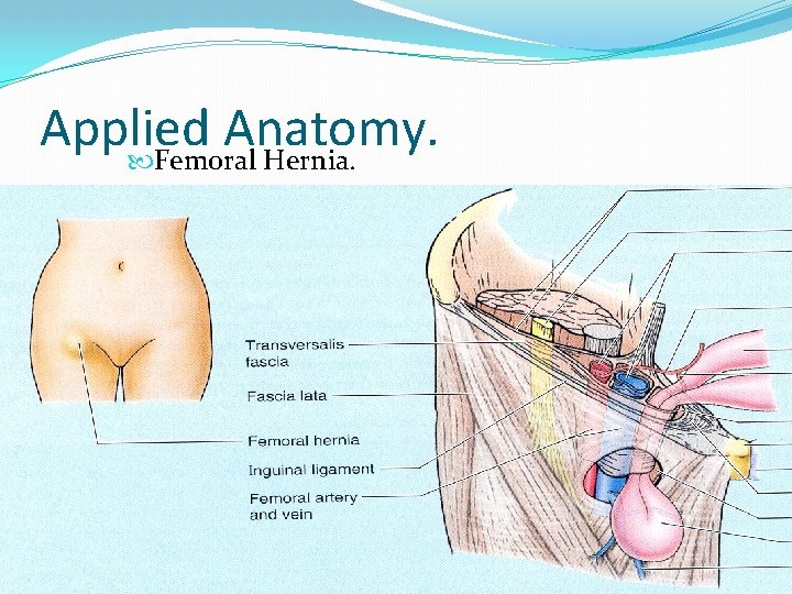 Applied Anatomy. Femoral Hernia. 