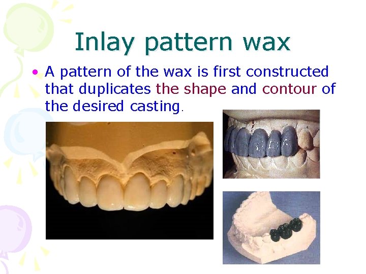Inlay pattern wax • A pattern of the wax is first constructed that duplicates
