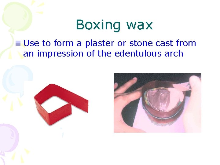 Boxing wax Use to form a plaster or stone cast from an impression of