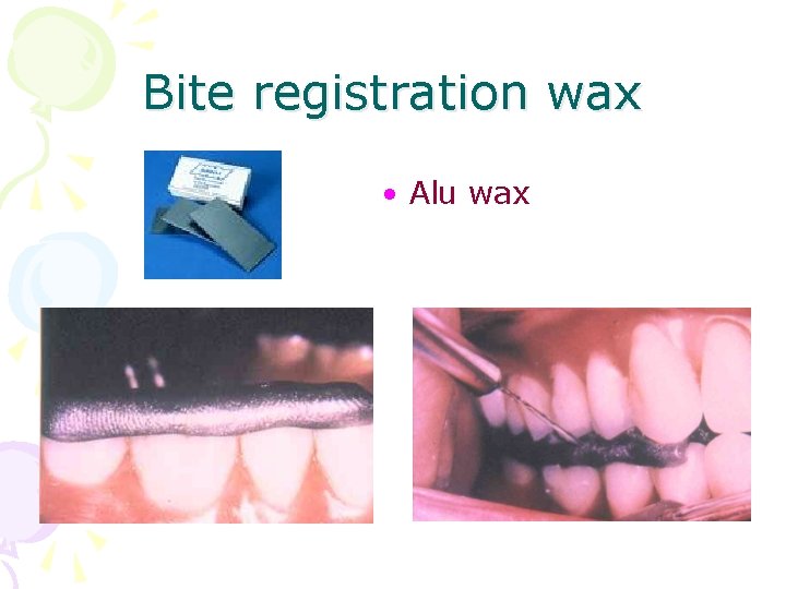 Bite registration wax • Alu wax 