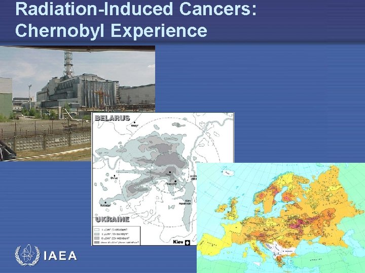 Radiation-Induced Cancers: Chernobyl Experience 