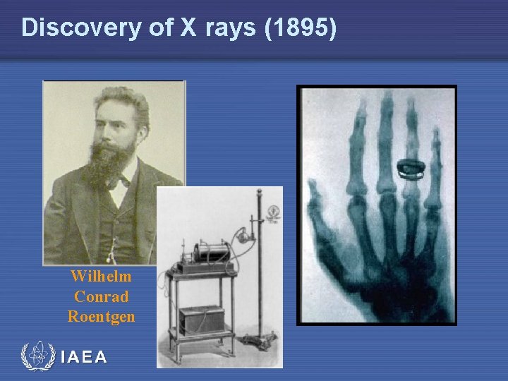 Discovery of X rays (1895) Wilhelm Conrad Roentgen 